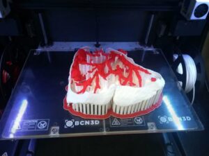 Die Kombination aus Röntgen- und 3D-Drucktechnologie ermöglicht es Ärzten, anhand von Scans des Patienten ein virtuelles Modell des betreffenden Bereichs zu erstellen. Dieses Modell kann dann entsprechend der tatsächlichen Abmessungen und Größe gedruckt werden.